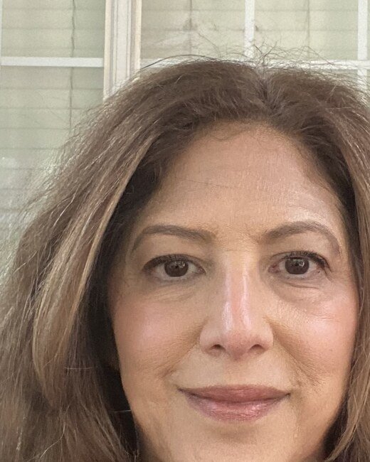 Erika, a real client, before and after: a brighter, lifted, more rested face