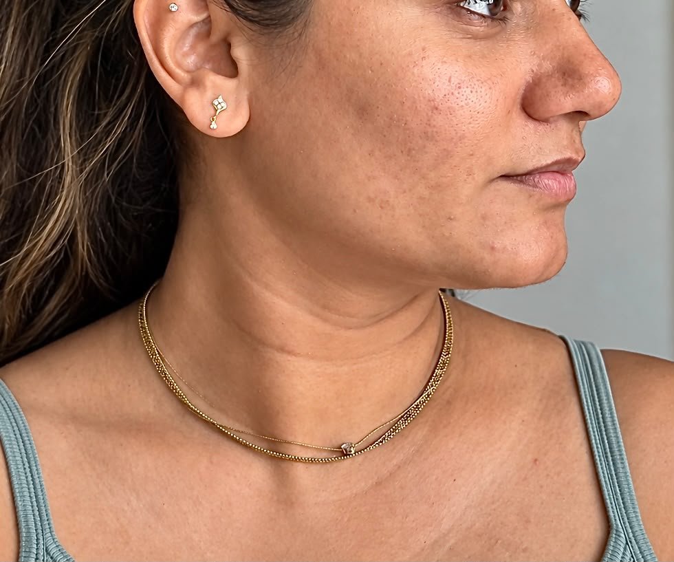 The same client's neck after: smoother, with the bands eased
