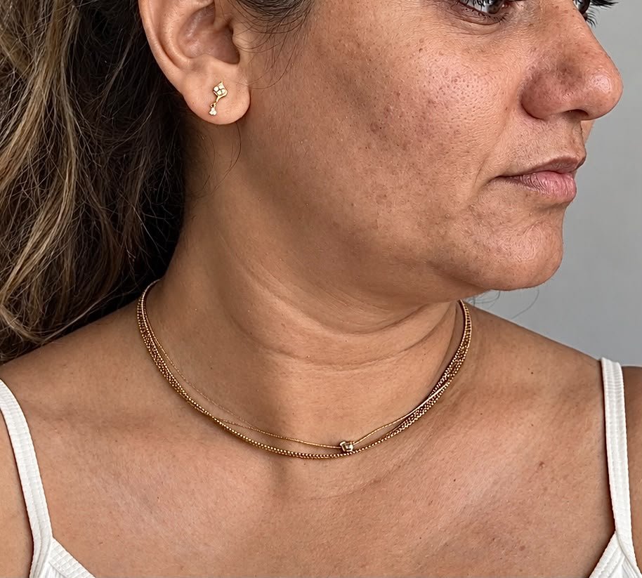 A client's neck before: visible cords and bands