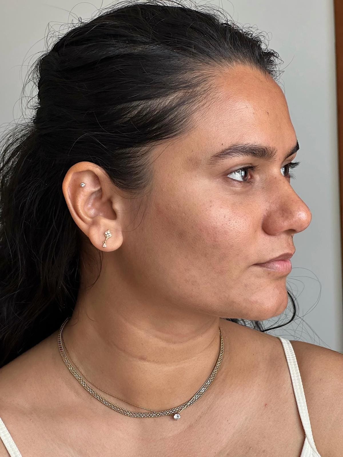 The same student's face after the 21-Day Face Yoga Mastery Program