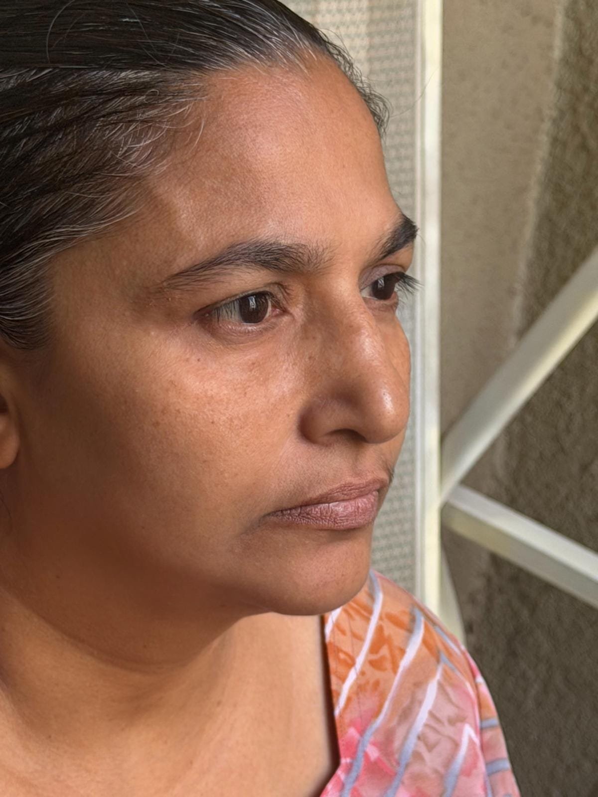 The same student's face after the 21-Day Face Yoga Mastery Program