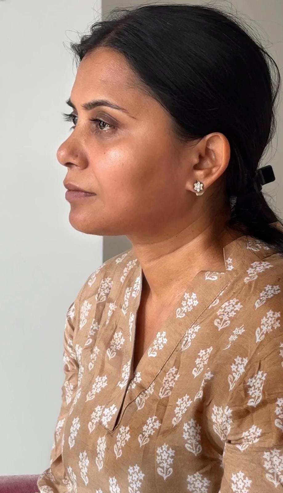 The same student's face after the 21-Day Face Yoga Mastery Program
