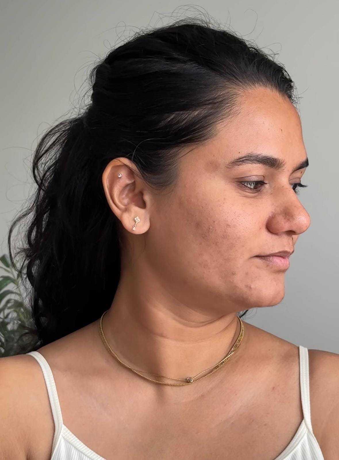 A student's face before the 21-Day Face Yoga Mastery Program