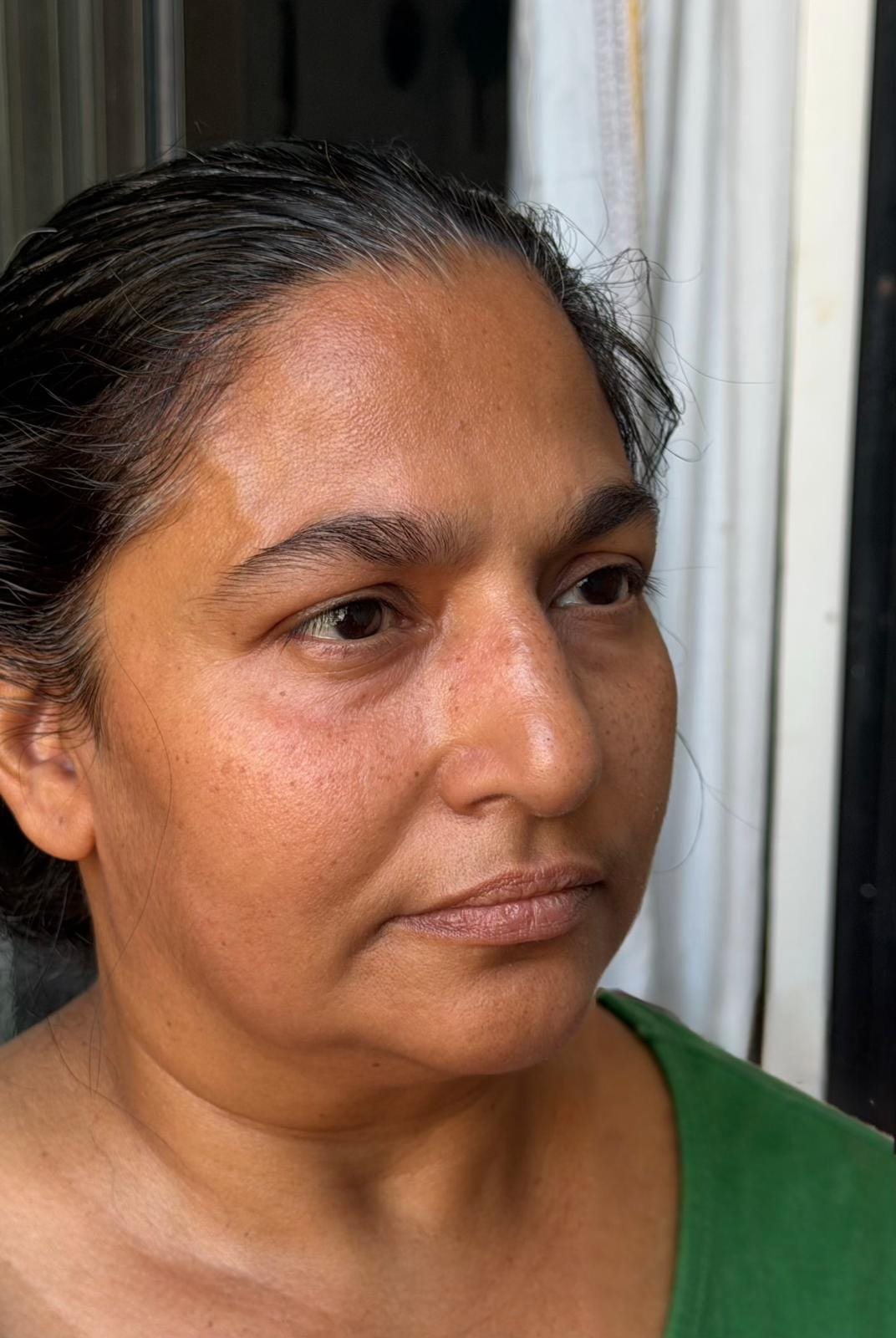 A student's face before the 21-Day Face Yoga Mastery Program