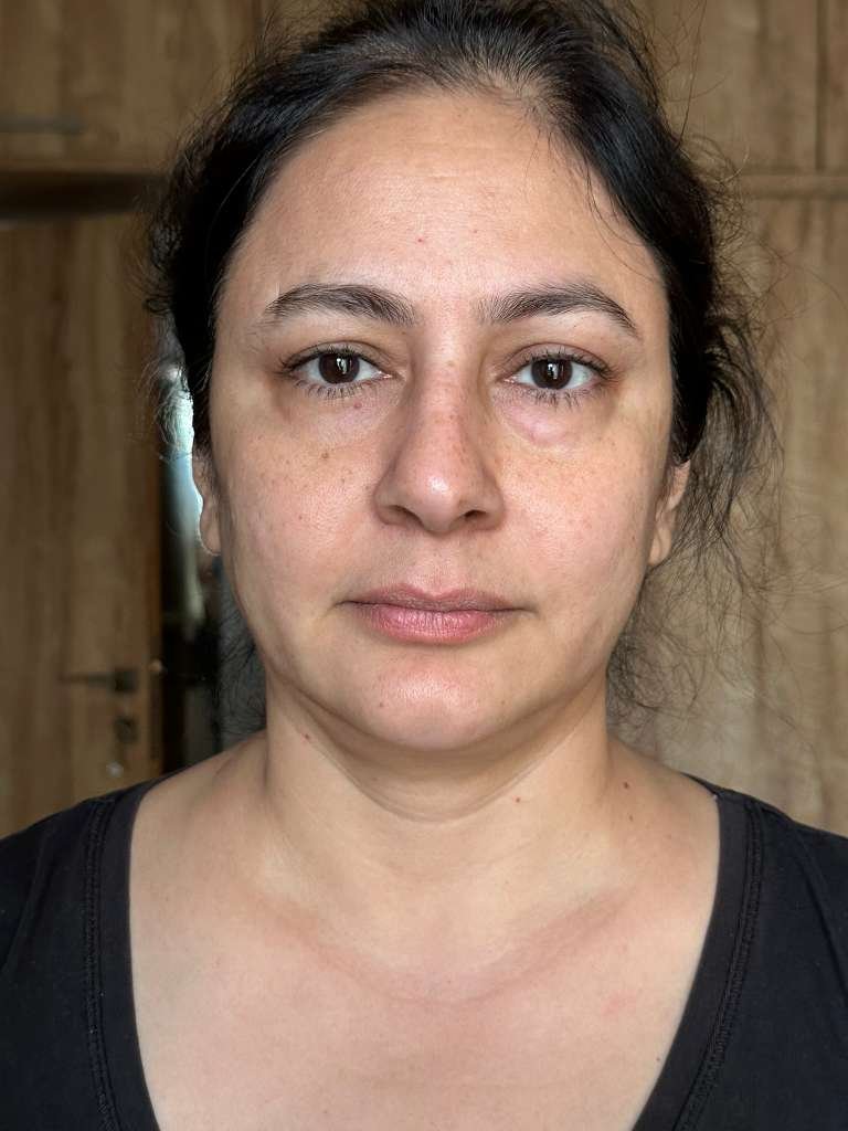 A student's face before the 21-Day Face Yoga Mastery Program